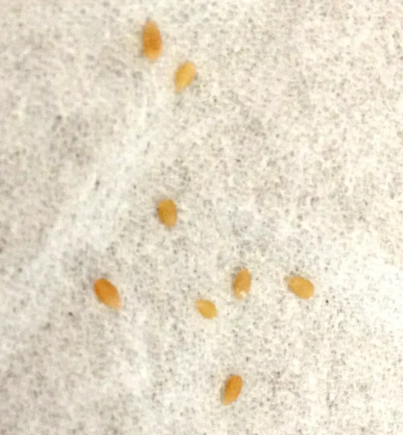 パッと見はただのゴマにしか見えない瓜実条虫の片節の写真